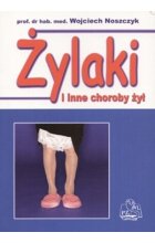 Żylaki i inne choroby żył
