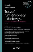 Toczeń rumieniowaty układowy, cz. 1. Rozpoznawanie i leczenie