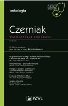 Czerniak. W gabinecie lekarza specjalisty.