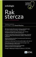 Rak stercza. Nowe spojrzenie