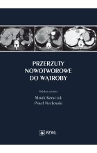 Przerzuty nowotworowe do wątroby