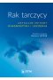 Rak tarczycy. Aktualne metody diagnostyki i leczenia