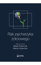 Rak pęcherzyka żółciowego