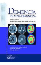 Demencja