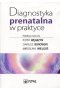 Diagnostyka prenatalna w praktyce