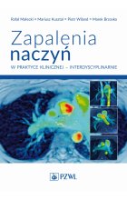 Zapalenia naczyń – w praktyce klinicznej interdyscyplinarnie