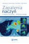 Zapalenia naczyń – w praktyce klinicznej interdyscyplinarnie
